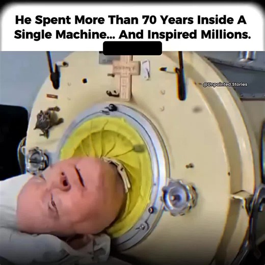 In 1952... At just six years old, Paul Alexander contracted polio. The illness left him unable to breathe on his own. To survive, he was placed inside an iron lung—a machine that used changes in air pressure to help him breathe. While the world advanced around him... Paul continued living with a device first developed decades earlier. Despite the challenges, he earned a law degree, became a lawyer, wrote a memoir, and inspired countless people with his determination. For more than 70 years, the 