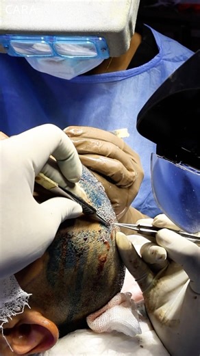 The Exact Process Doctors Use for Natural Hair Growth