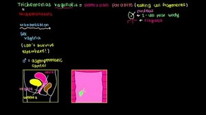 What is trichomoniasis?