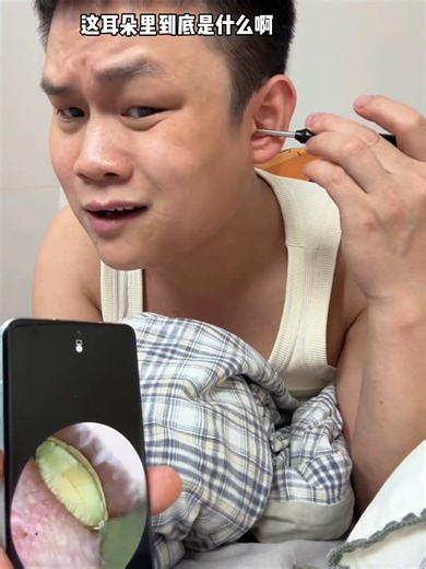 Visual_Ear_Spoon 461 #abstract #ear #clearn #decompressionvideo #CleaningEar #tool