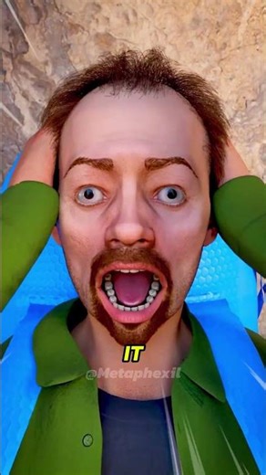 How Does a Cast Saw Cut Plaster But Not Your Skin? 😳