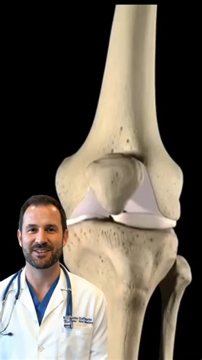 Acabe com as dores nas articulações de forma 100%natutal #DoresArticulares #SaúdeDasArticulações#SemDor#DorNoJoelho#DorNasCostas #Fisioterapia#doresnaspernas #alongamento#artrite#artrose