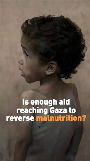 Is enough aid reaching Gaza to reverse malnutrition?