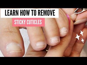 Learn How To Heal Ingrown Toenail at Home: PedicureTutorial and Sticky Cuticles