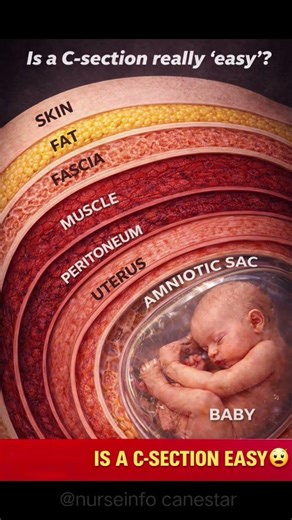 👉 C-Section Is NOT Easy 😳 (See This!)