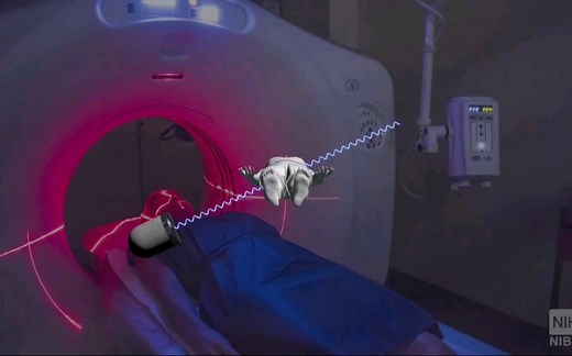 CT工作原理，3D演示。。