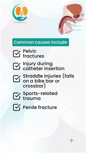🚨 Urethral Injury: Often Hidden, Never Harmless #drpabitramisraurologist #besturologis