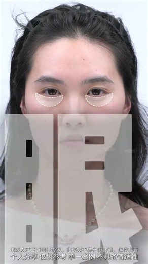 So this is the way to make a chubby face look more beautiful #Chubby face#Become