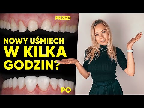 Flow injection - NOWE ZĘBY NA JEDNEJ WIZYCIE?