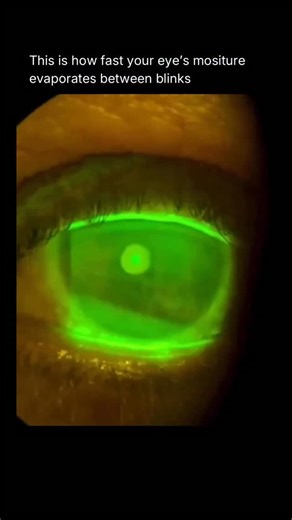 How Things Work on Instagram: "Moisture evaporates from the eye extremely quickly between blinks because the tear film is only a few micrometers thick and constantly exposed to air. After each blink, a fresh tear layer spreads across the cornea, but evaporation begins almost immediately, driven by airflow, temperature, and humidity. In dry or windy conditions, significant tear thinning can occur in under one second, which is why blink rate increases subconsciously. Blinking restores moisture, re