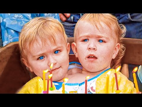 Two heads, one body and a heartbreaking story