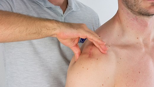Paxinos Sign | Acromioclavicular Joint Pathology Assessment