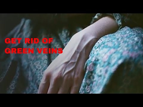 How To Get Rid OF Green Veins|Home Remedies Natural Cure|