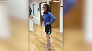 Double Amputee Wears Dress For First Time On Wedding Day Happily TV