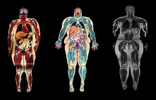 Métodos de evaluación de la composición corporal | Nutri4train