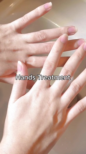 Hands Treatment 🫧🧴 #handstreatment #handsroutine #ครีมSkinEditor #SkinEditor