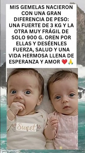 ✨ El milagro de nuestras gemelas: dos luchadoras con destinos diferentes ❤️