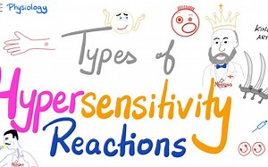 Hypersensitivity Reactions(TypeI,II,III, IV HSN)Most Comprehensive Explanation！