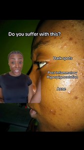 Wave goodbye to post-acne marks with these 3 simple steps 👋 1️⃣ DermoPurifyer Triple Effect Cleanser: Clear away impurities for a fresh start. 2️⃣ Triple Effect Serum: Target and fade those stubborn marks. 3️⃣ Protective Fluid: Shield and hydrate your skin for a radiant glow. 📷:@skincarebysaree | Eucerin