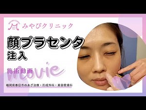 顔プラセンタ注入｜みやびクリニック｜形成外科・あざ治療・美容皮膚科