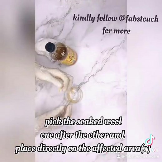 Natural Skin Tag Removal Tips: Apple Cider Vinegar Method