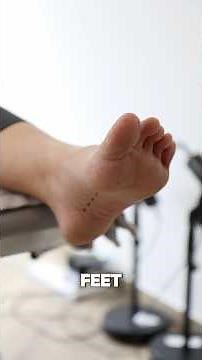 High Arch Feet (Cavus Foot) Explained by a Podiatrist | Why High Arches Cause Foot Pain & what to do
