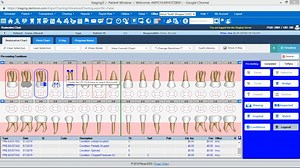 Denticon Software Update 5.10.19