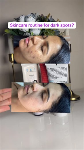 Zainab Alam on Instagram: "How to treat dark spots Facewash @diligencehealthcareofficial Maxdiff @myjenpharm Sunblock @nirvanabotanics Rebute @deutech_skincare . . . . . . . #acnemarks #dullskin #darkspots #virałpost #insta #explorepage"