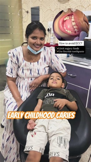 😍✨How to avoid early childhood caries in kids ? #hyderabaddentist #dentist #trend #smile #cavities