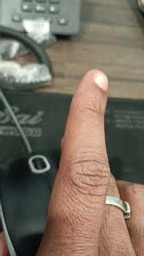 SHARE SYSTEM INTERNET.