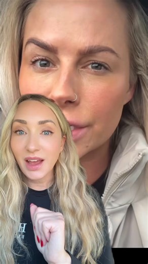 Nicole Smith | California | Botox, Filler, Anti-aging on Instagram: "This is what happens when your Botox fails… It is not always the injectors fault. Your muscles may be stronger on one side! Don’t worry it can typically be fixed with a small touch up! @e.m.i.l.ygram Thank you for sharing! #vlog #beautytips"