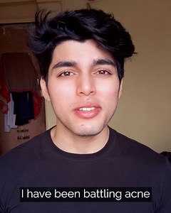 4.8M views · 1.8K reactions | “My face looks clearer and I feel more...