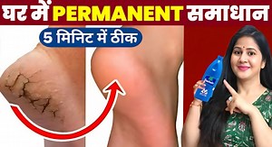 💯Rid Of Cracked Heels/Cracked Heels Repair At Home #shorts #skincare #crackedheels #heels #ytshorts #beauty #beautytips #viral | Beauty tips