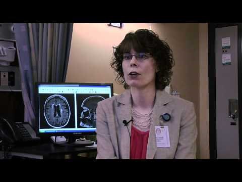 Making sure minor stroke stays that way