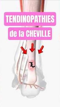 TENDINITES de la cheville : exercices de renforcement. #tendinite #santé #renforcementmusculaire