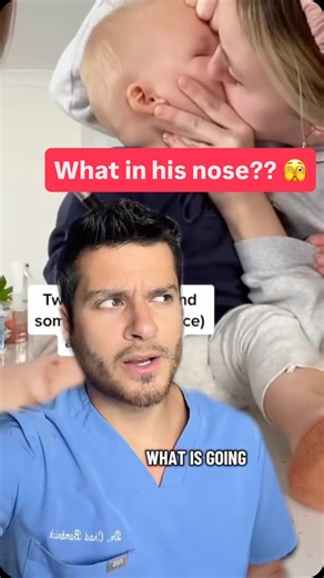 Dr. Chad on Instagram: "Send this to someone with kids to save them an ER visit! It’s super common for kids to get things stuck up their nose and this is a huge pro tip for anyone who is around children!"