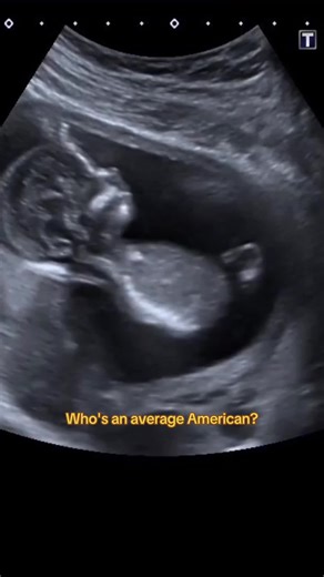 Who is an average American? An average of American demographic stats says a profile around a white woman in her late 30s (coz there are 98 males for every 100 females in America), possibly with German ancestry, married,.. living in a single-family home, with some college education, and navigating moderate income/debt, while spending significant time on digital entertainment rather than reading or extensive international travel. She’d be part of the largest demographic which is White, non-Hispani