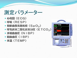 心電図モニタ（動画ファイル）