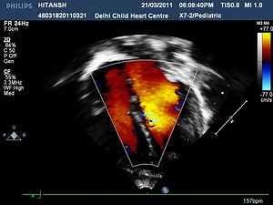 Pediatric and Neonatal Echo Training Level 2
