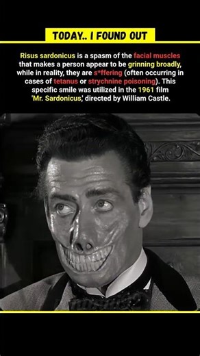 The Smile That PARALYZED Face #facts #history