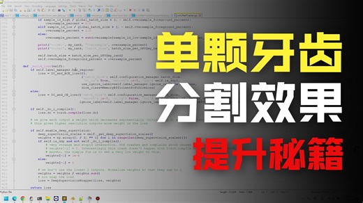 自定义的nnUNet训练器，结合Focal Loss 和 Dice Loss，来处理背景和小的牙齿区域不平衡的类别问题