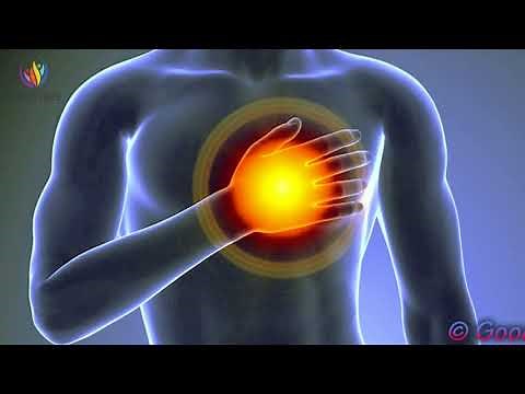 Chest Pain & Heart Pain Relief: Pain Relief Frequency
