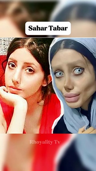 Sahar Tabar worst plastic surgery fails