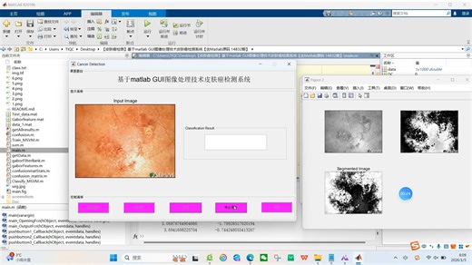 【皮肤癌检测】基于matlab GUI图像处理技术皮肤癌检测系统【含Matlab源码 14832期】