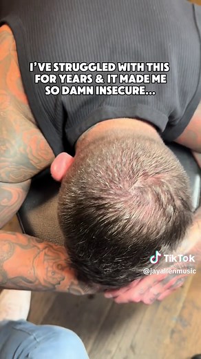 Incredible Before & After: Bald Head Tattoo Transformation