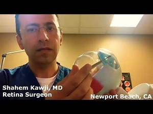 Does the Vitreous Gel Come Back After Vitrectomy Surgery?