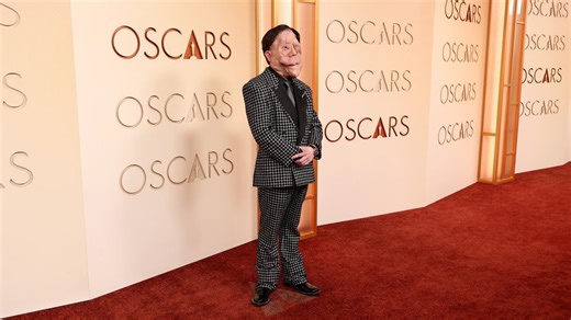 Actor Adam Pearson hits back at comedian’s ‘hateful’ tweet about his appearance