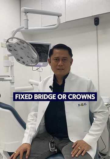Fixed Bridge vs Crowns: Which Is Best for Your Teeth?