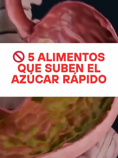 5 Alimentos que Aumentan el Azúcar Rápido