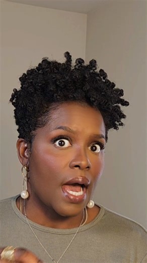 Sisi Nike 🇳🇬 | Digital Creator |📍Jersey on Instagram: "Chiiiiiiiilllleeee. I finally went to the dermatologist to address my scalp issues in my crown. FULL VIDEO UP ON MY YOUTUBE NOW Comment WATCH and I'll dm you a link to watch and hear all the details If you suspect your hair is thinning and can't explain why, I recommend you watch!"